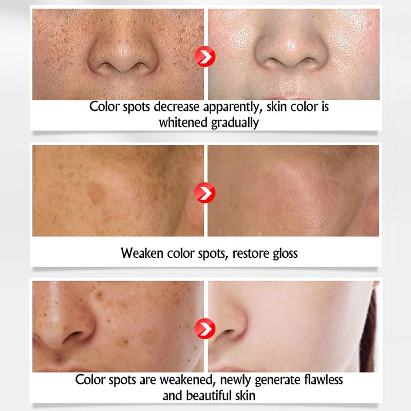Collagen Freckles Whitening  Cream Hyaluronic Acid Anti-Aging