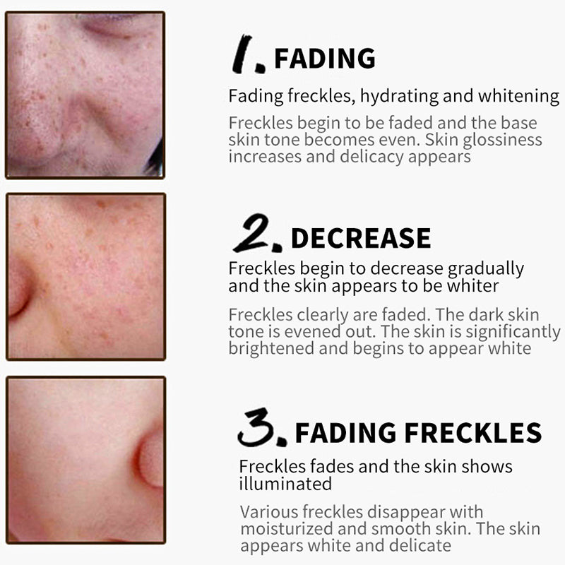 Collagen Freckles Whitening  Cream Hyaluronic Acid Anti-Aging