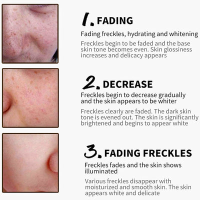 Collagen Freckles Whitening  Cream Hyaluronic Acid Anti-Aging