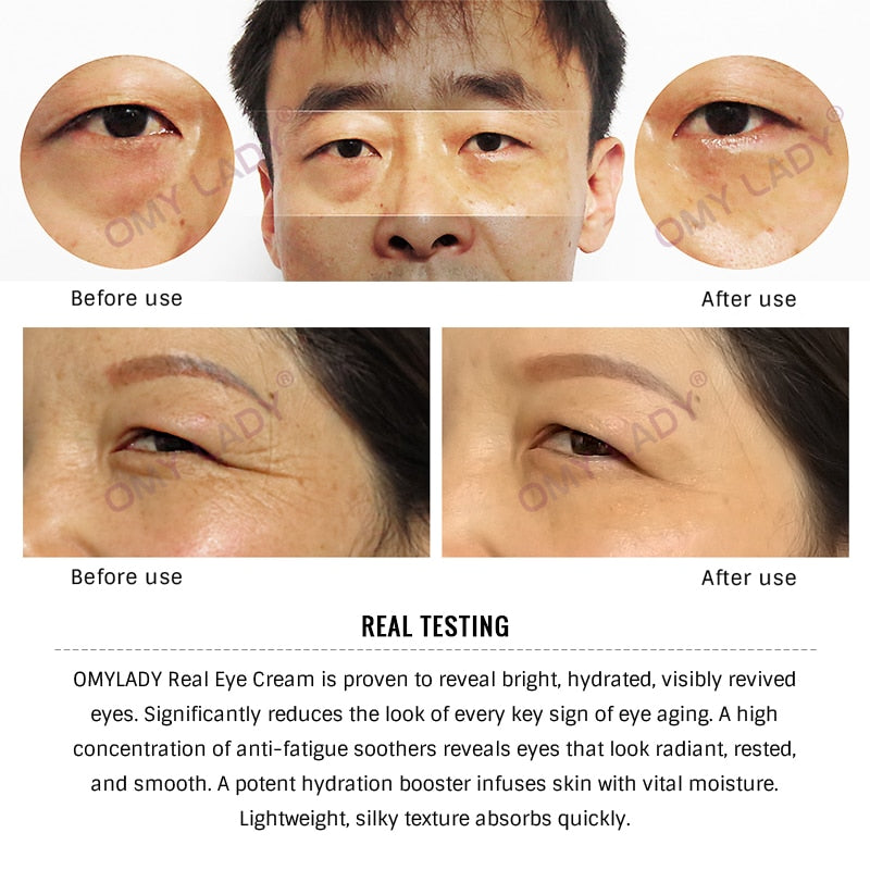 OMYLADY EyeCream Lnstant Remove Eyebags