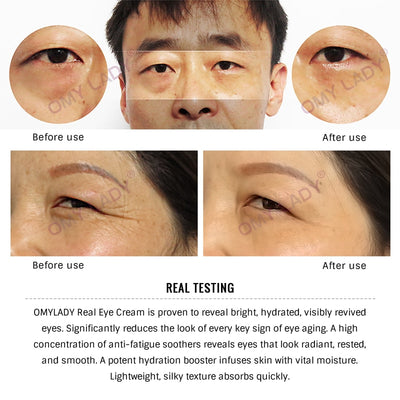 OMYLADY EyeCream Lnstant Remove Eyebags