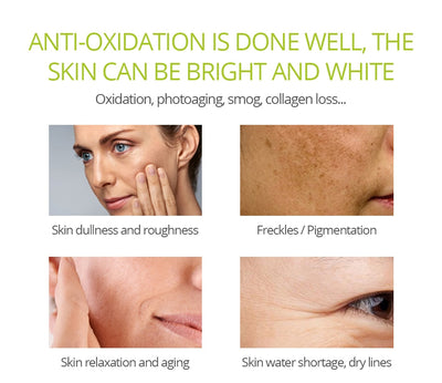 VIBRANT GLAMOUR Vitamin C Whitening Face Serum Hyaluronic Acid Cream Remover Acne Treatment Fade Dark Spots Anti-Aging Skin Care