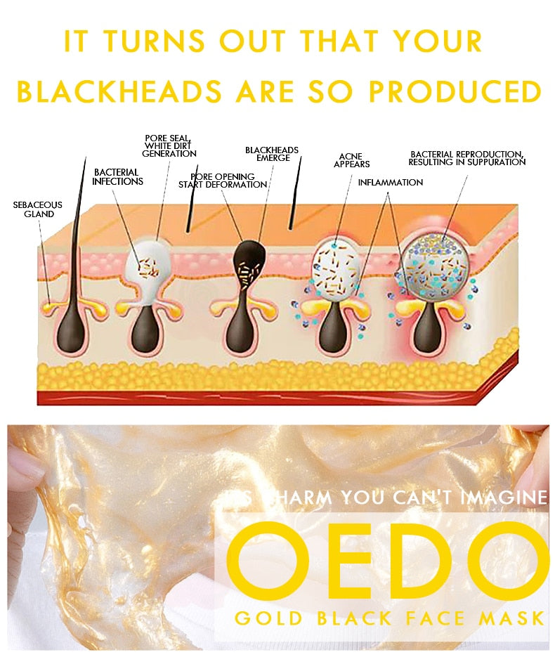 OEDO Gold goes to blackhead, shrink pores, remove acne remover mask and improve rough skin moisturizing skin care cream.