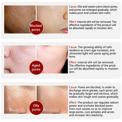 Collagen Shrink Pores Hyaluronic Acid Serum