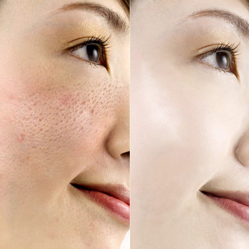 Collagen Shrink Pores Hyaluronic Acid Serum