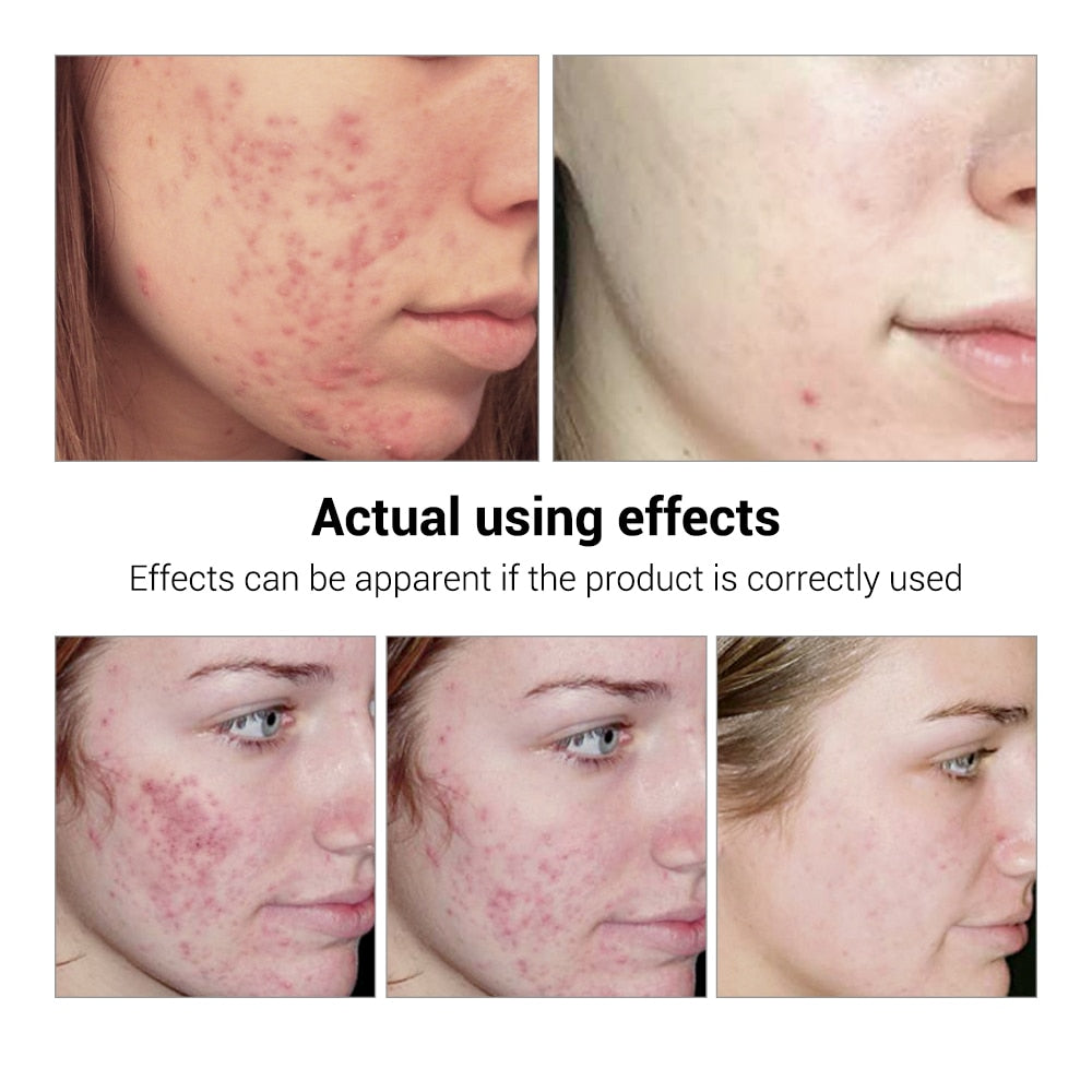 Collagen Shrink Pores Hyaluronic Acid Serum