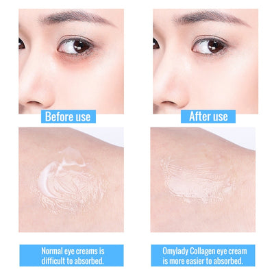 Eye Cream Firming Whitening Moisture Hydra Anti Wrinkle Remove Circles