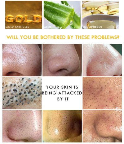 OEDO Gold Remove Blackhead Mask Shrink Pore Improve Rough Skin Acne
