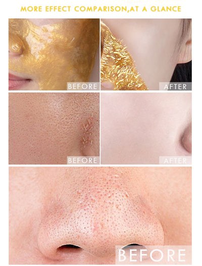 OEDO Gold Remove Blackhead Mask Shrink Pore Improve Rough Skin Acne