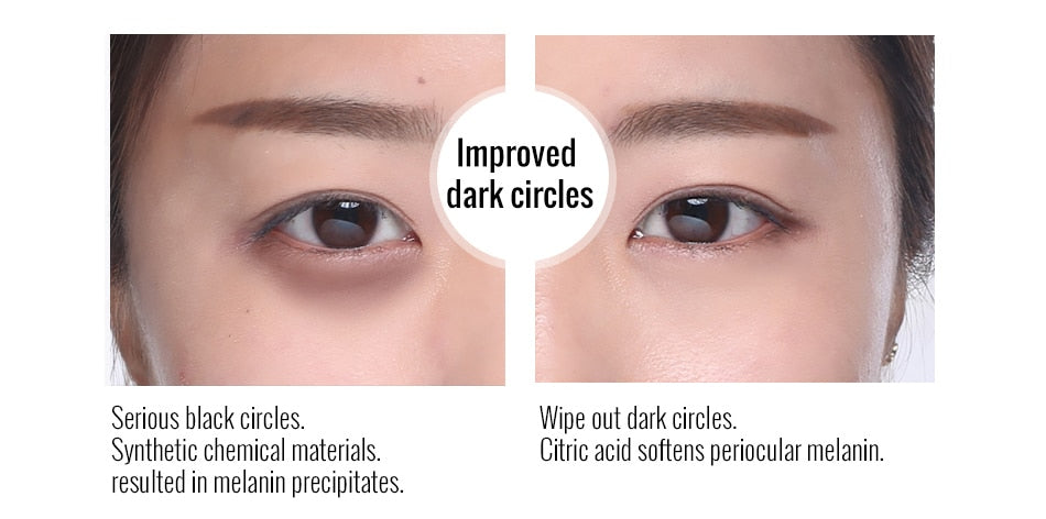 Eye Cream Firming Whitening Moisture Hydra Anti Wrinkle Remove Circles