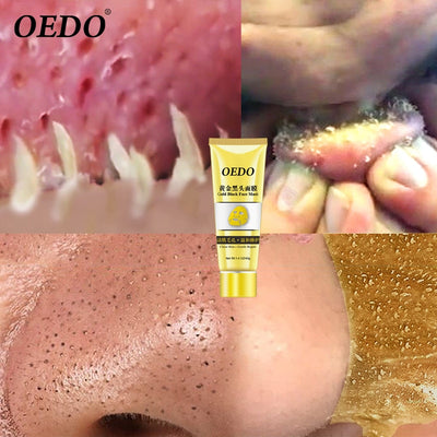 OEDO Gold goes to blackhead, shrink pores, remove acne remover mask and improve rough skin moisturizing skin care cream.