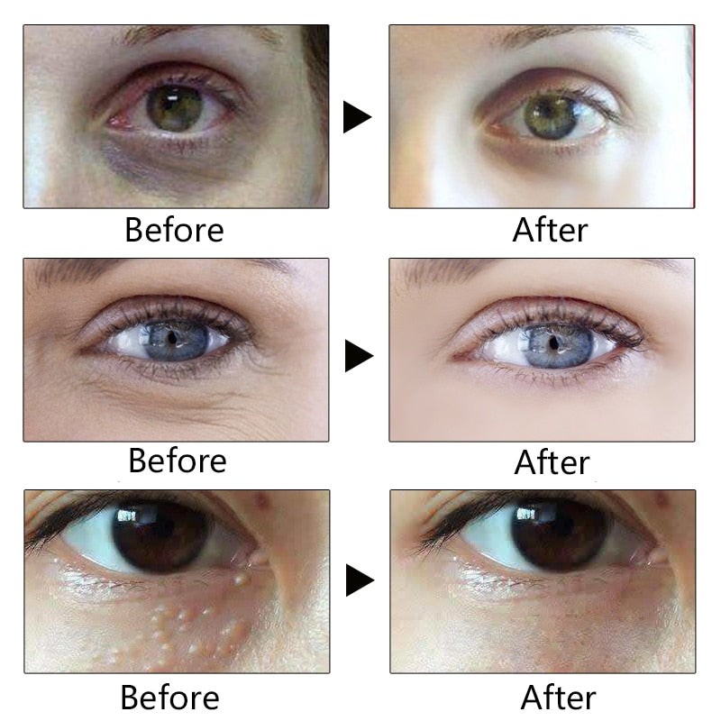 Collagen Repair Eye Cream Anti Aging Remove Dark