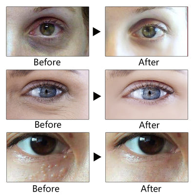 Collagen Repair Eye Cream Anti Aging Remove Dark
