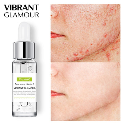 VIBRANT GLAMOUR Vitamin C Whitening Face Serum Hyaluronic Acid Cream Remover Acne Treatment Fade Dark Spots Anti-Aging Skin Care